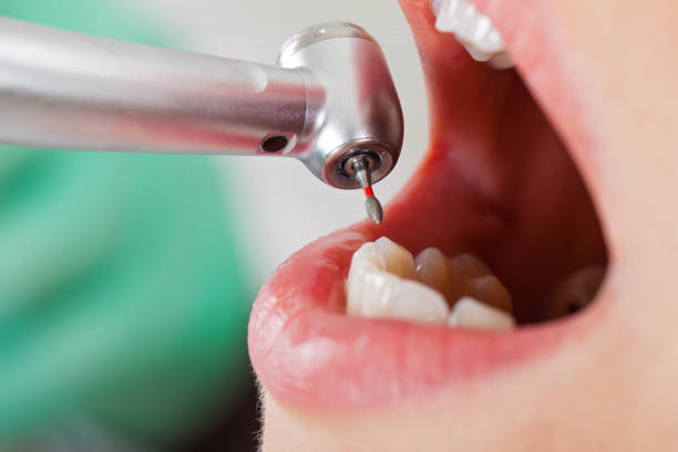 Best Pediatric Emergency Dentist in Suffolk, VA